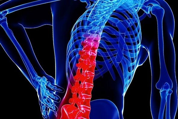 Les raisons du développement de la thoraxostéochondose