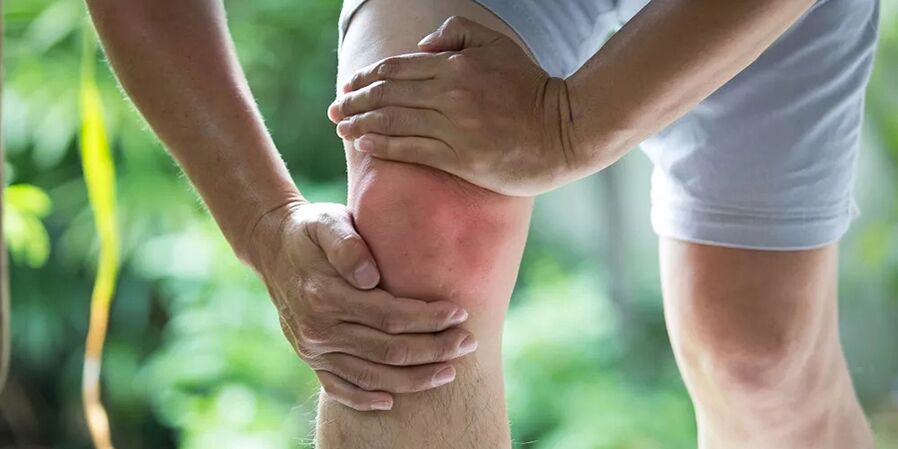 Douleur intense lors d'une activité physique due à l'arthrose de l'articulation du genou